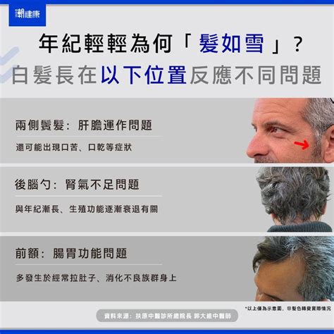 額頭白毛|突然長白髮有3大隱患，尤其這些位置是身體在求救